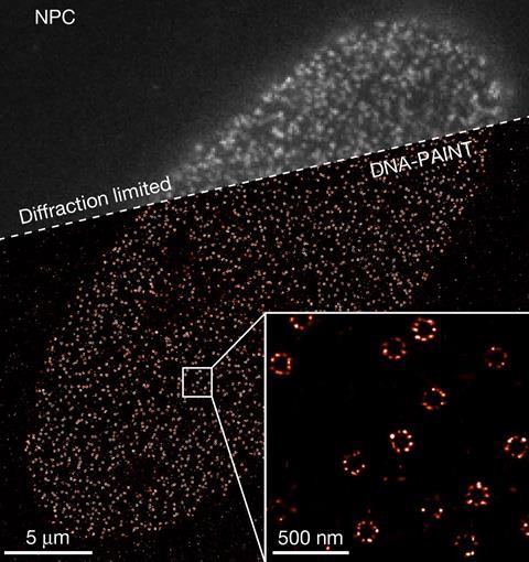 An oval made up of tiny rings shown in an inset on a 500 nm scale. The full image has a 5 micrometre scale and is divided into a Diffraction limited area which is greyscale and blurry. The lower portion is labelled DNA-PAINT is black and red and sharp