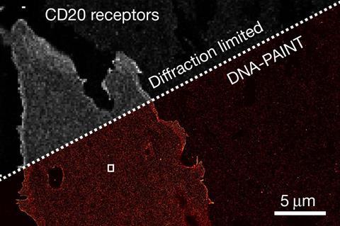 An image of a blob titled CD20 receptors with the top half labelled Diffraction limited and ispixellated in grey scale and the bottom labelled DNA-PAINT is sharper in red and black. There is a 5 micrometre scale in the corner.