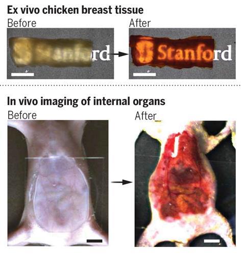 Yellow food dye could give doctors a new way to look beneath the skin