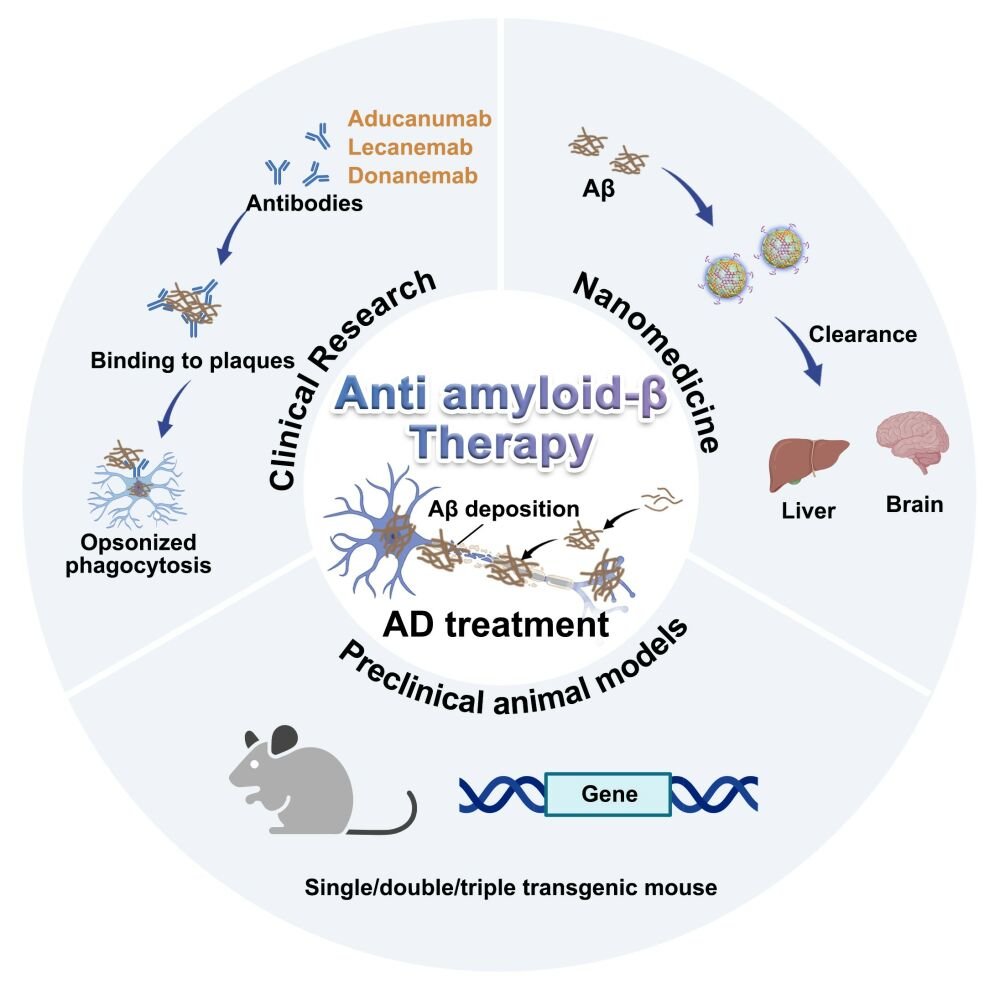 Europe Evaluates Authorization Procedure for Alzheimer's Antibody Therapies