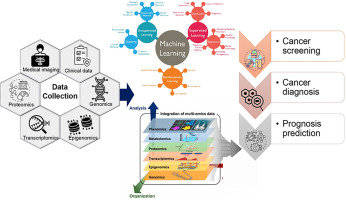 "Recent Breakthrough in Machine Learning Provides Hopeful Progress in Battling Lethal Brain Cancer"