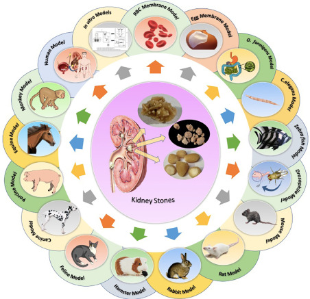 "Revealing the Role of Kidney Bacteria in Stone Development"