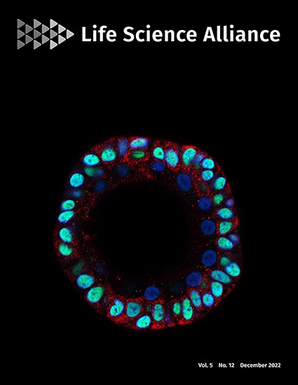 "RNA Segments Once Deemed 'Junk' Play a Role in Protein Synthesis and Cellular Stress Reactions"