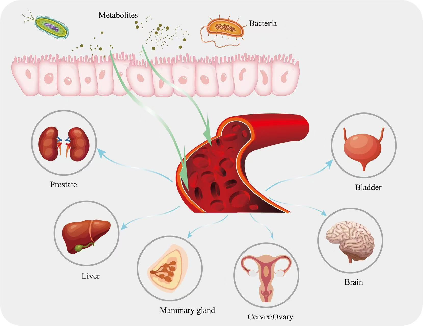 Gut Bacteria Metabolite Recognized as a Catalyst for Pre-Leukemic Cell Growth