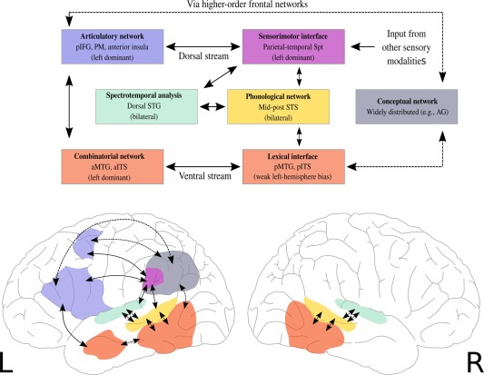 AI Language Models Display Brain Activity Patterns Similar to Those Observed in Human Aphasia Patients