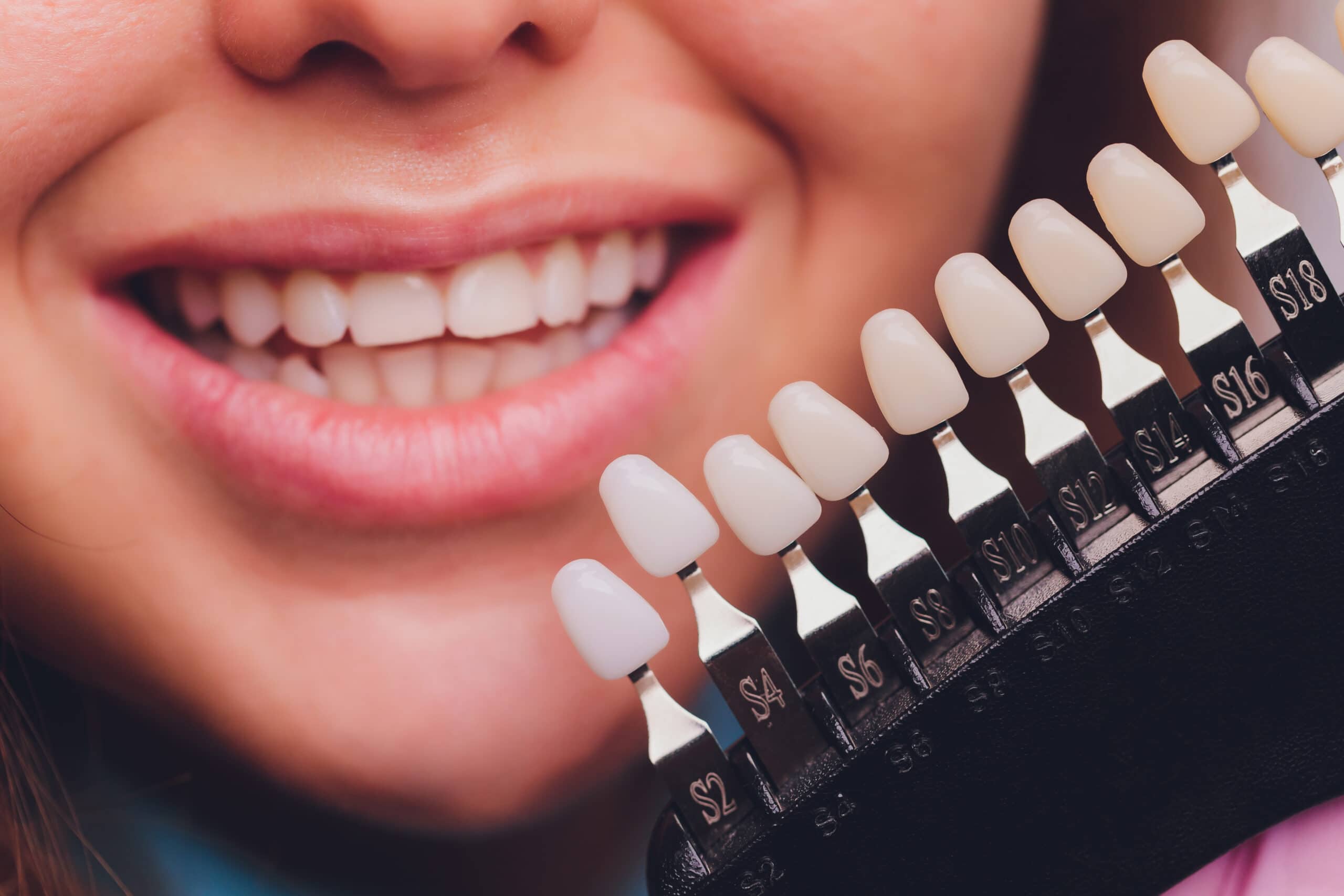 Early Teeth Served as Sensors Instead of for Mastication