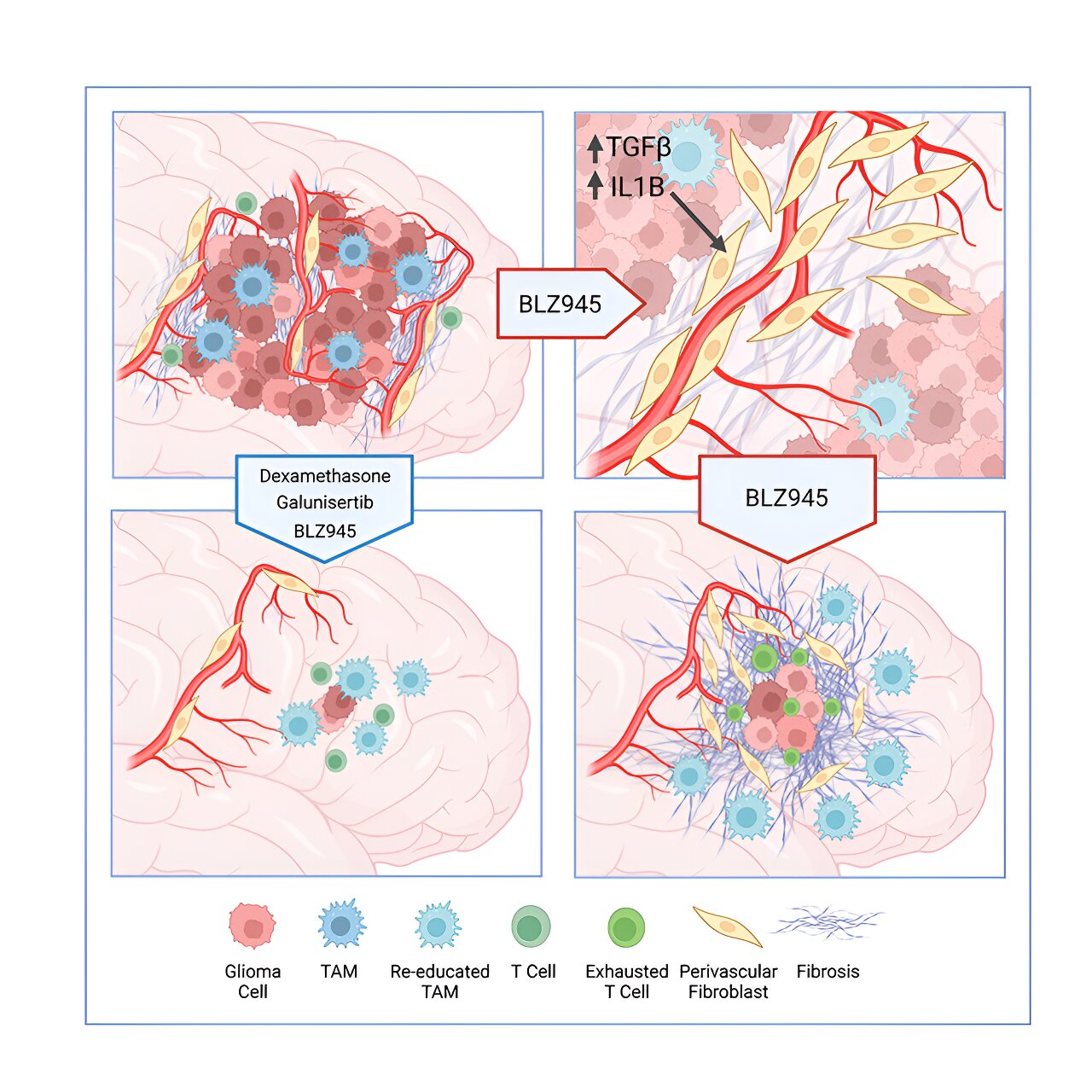 Gabapentin Linked to Enhanced Survival Rates in Patients with Brain Cancer