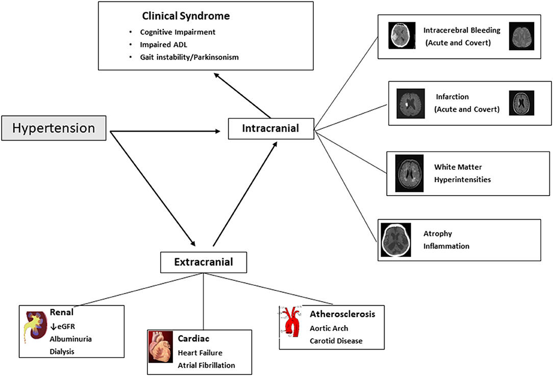 Heart Rhythm Variability as an Indicator of Cognitive Deterioration in Senior Individuals