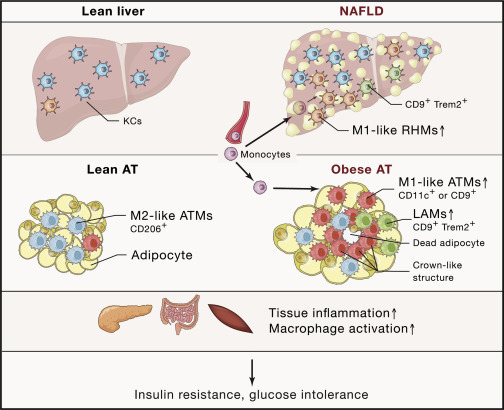 Overactive Neurons Associated with Increased Blood Sugar Levels in Diabetes