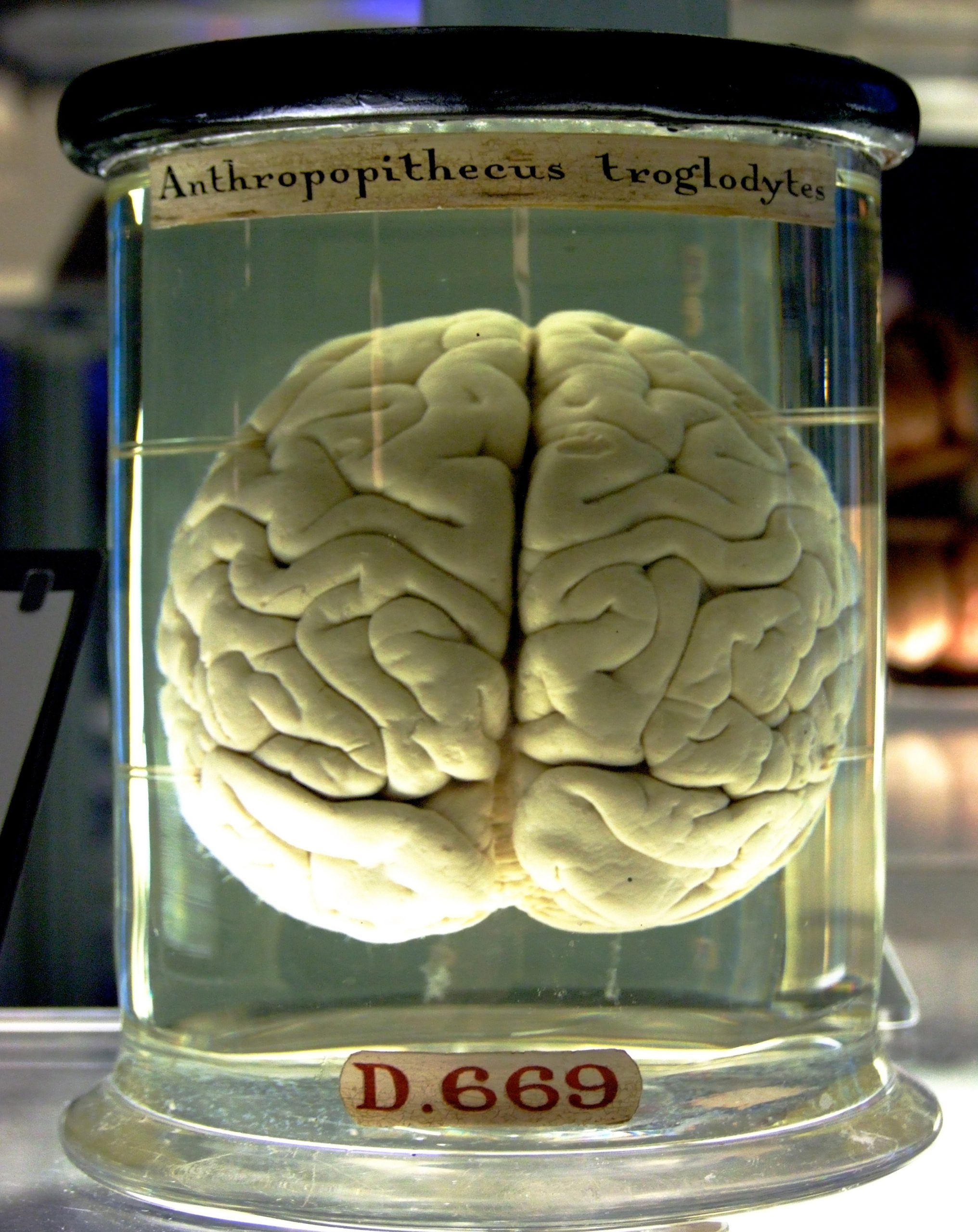 Oxygen Drops Administered While Sleeping Connected to Alterations in Brain Areas Related to Memory