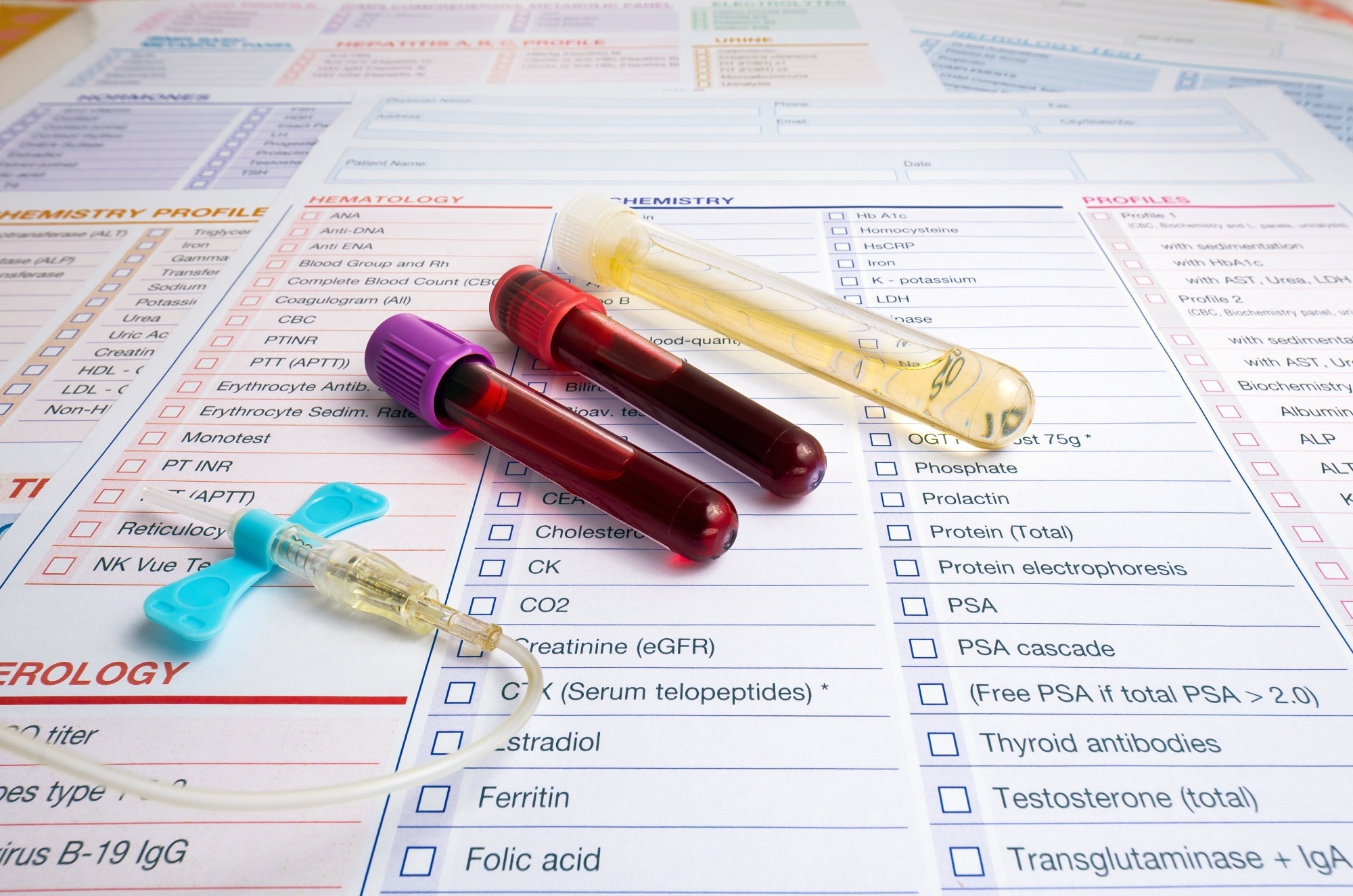Protein Biomarkers Might Allow for Sooner Diagnosis of Dementia Onset in Middle Age