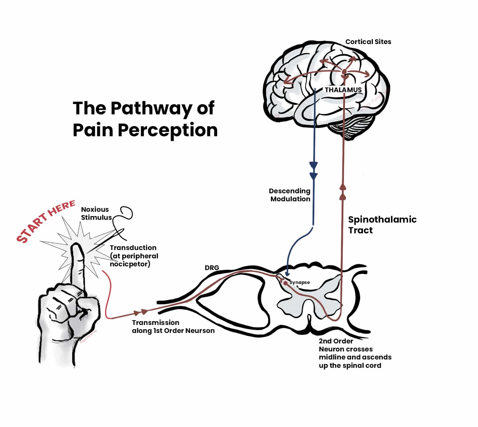 Assessing the Morality of Species Elimination in Research Initiatives to Relieve Pain