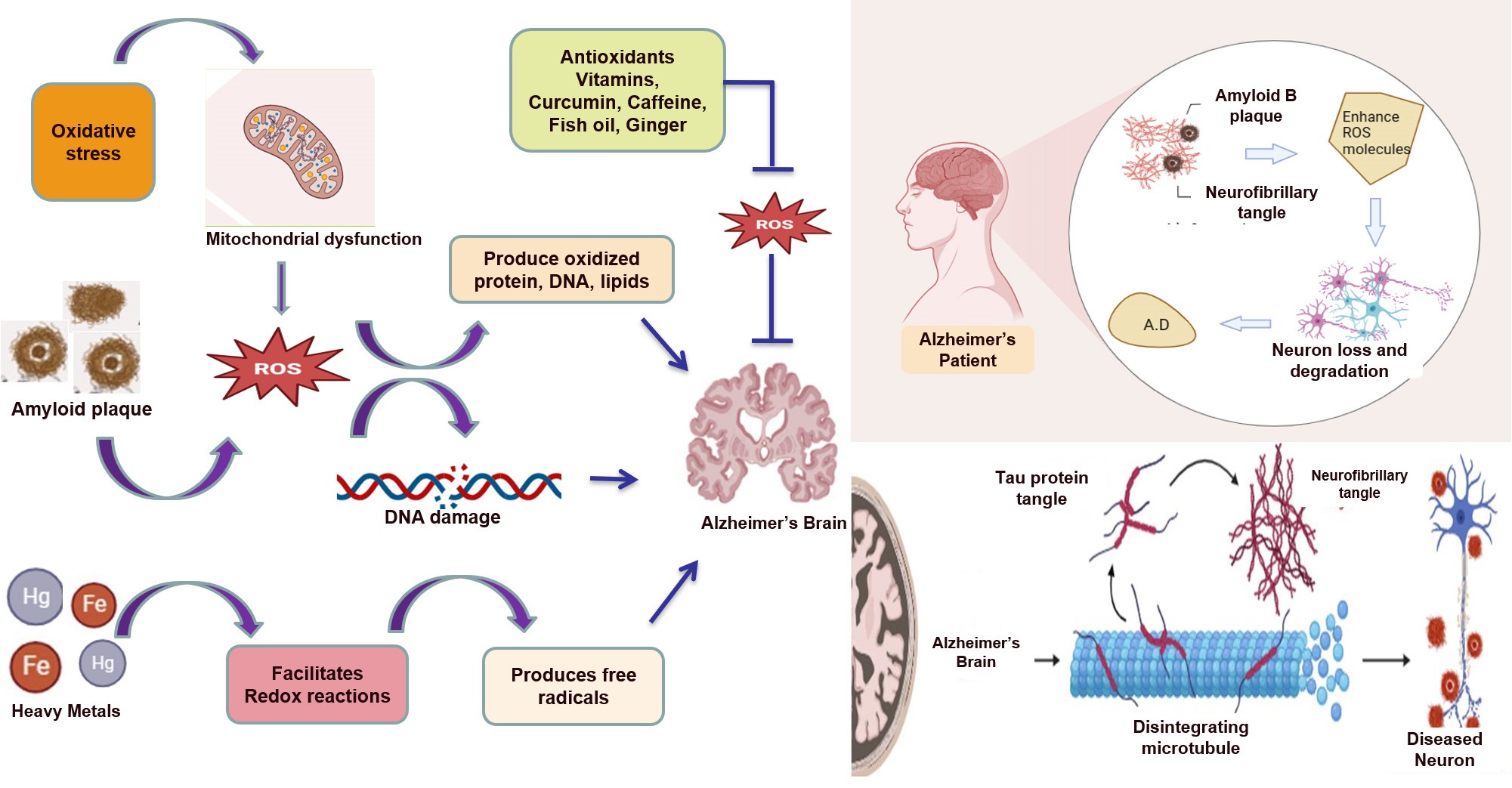 A Sole Gene Possibly Associated with Most Alzheimer's Instances