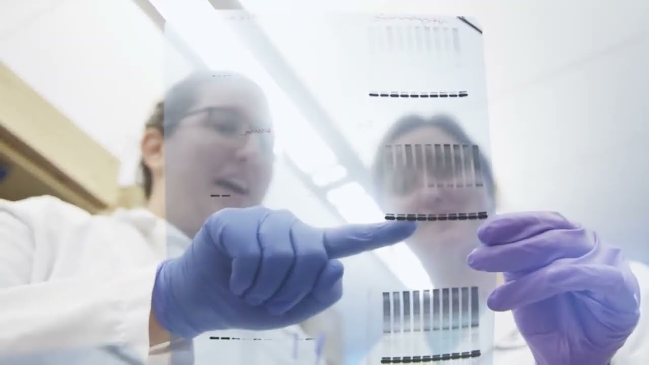 Identifying Blood Biomarkers for Triggers of Multiple Sclerosis