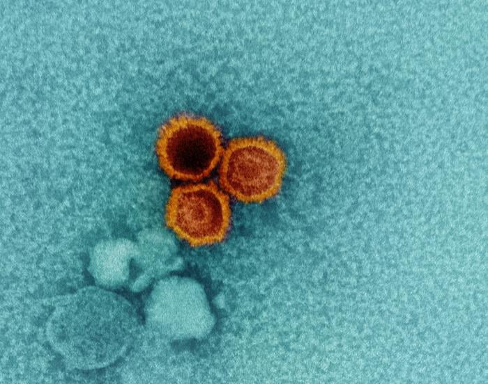 Newly Created Antibodies Successfully Inhibit Hard-to-Target Virus