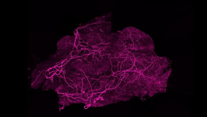 Brown Fat Compound Presents Possibilities for Enhancements in Bone Disorder Therapy