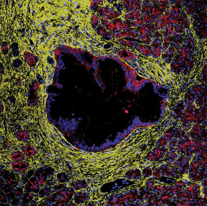 Concealed Firewall Mechanisms Influence Pancreatic Precancer Progression