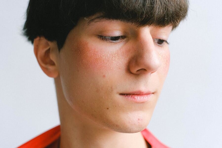 The Variations in Proteins Between Sensitive Skin Syndrome and Rosacea