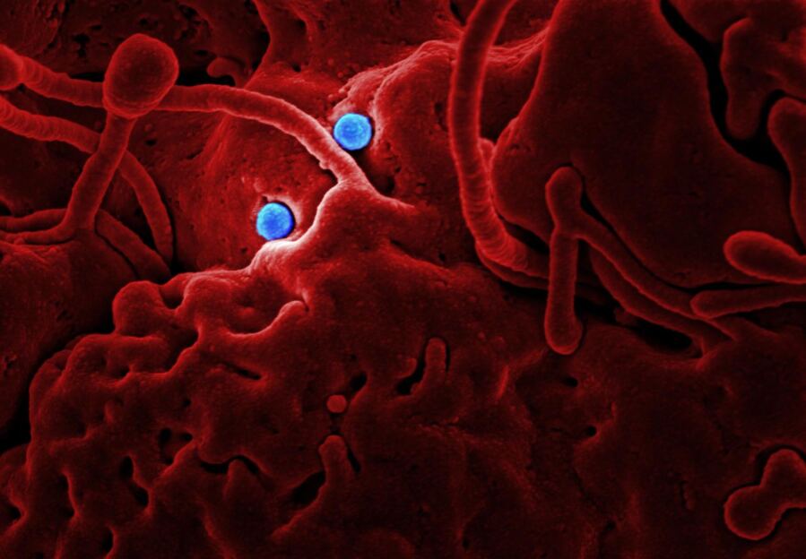 Grasping How a Detectable HIV Test Outcome Might Suggest Virus Suppression