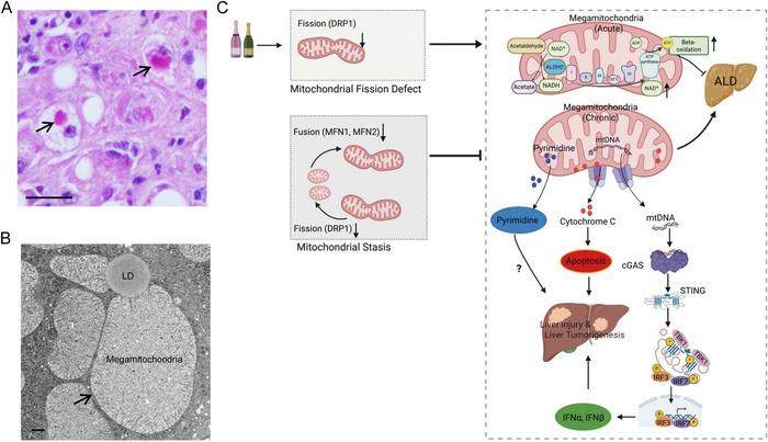 The Development of Large Mitochondria in Heavy Alcohol Consumers as a Short-Term Liver Safeguard Strategy