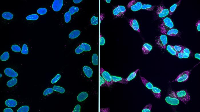 Unveiling a Novel Mechanism of Brain Cell Death Possibly Illuminates the Way Dementia Inflicts Harm on Neurons