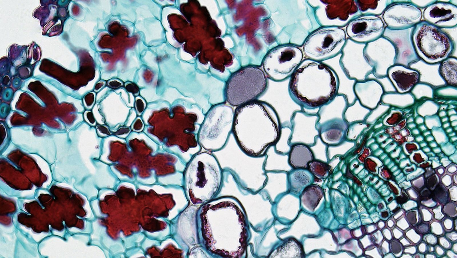 "Blood-Brain Barrier Permits Glucose and Ketones But Prevents Most Small-Molecule Medications with Tight Junctions Measuring 4 Nanometers"