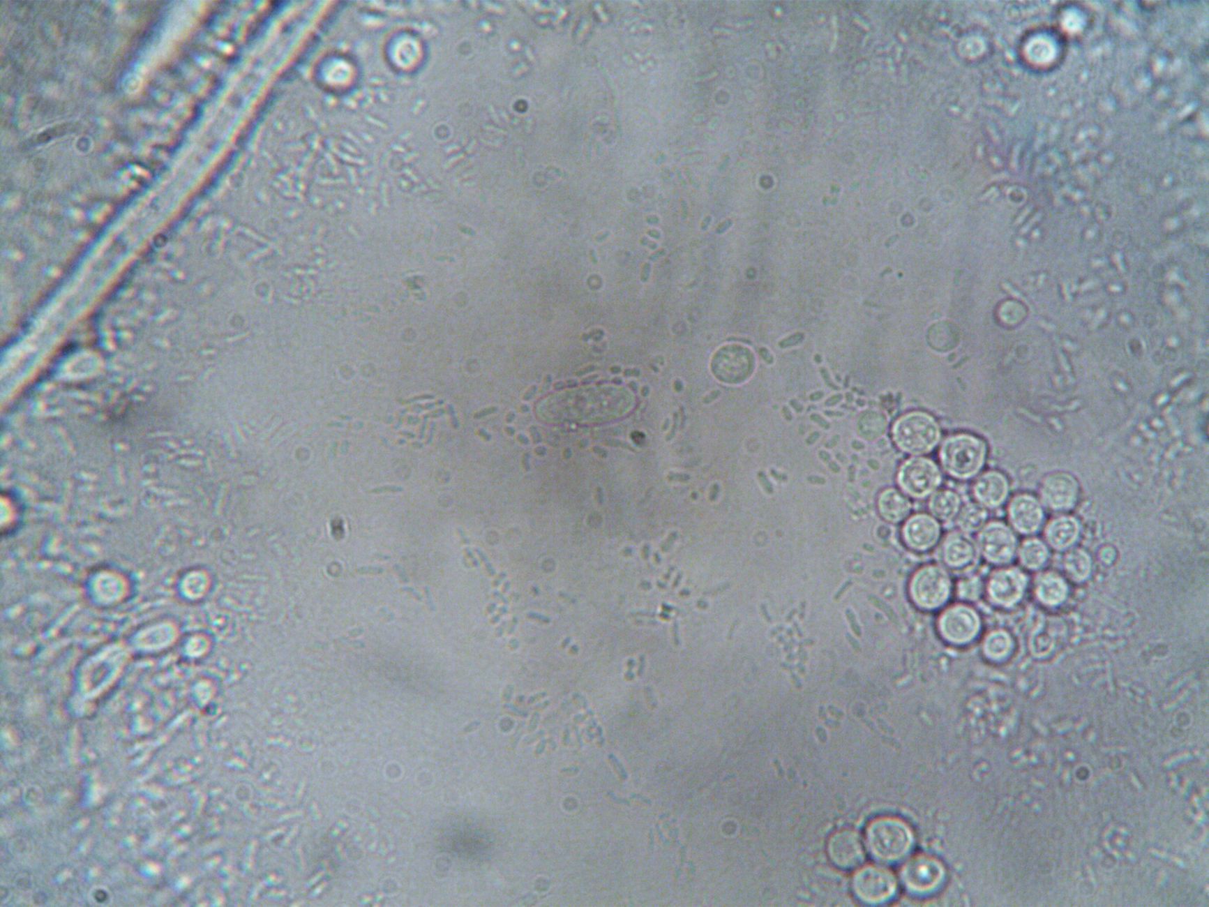 Researchers Uncover Particles from the Gut That Affect Inflammation and Aging; Particles from Young Animals Rejuvenate the Process