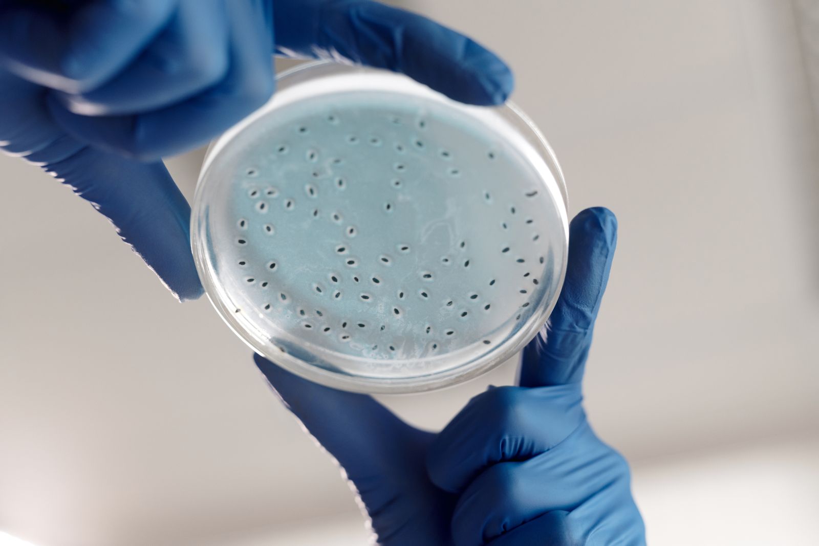 "The Unveiling of Penicillin by Alexander Fleming in September 1928: The Fortuitous Discovery That Greeted the Antibiotic Age"