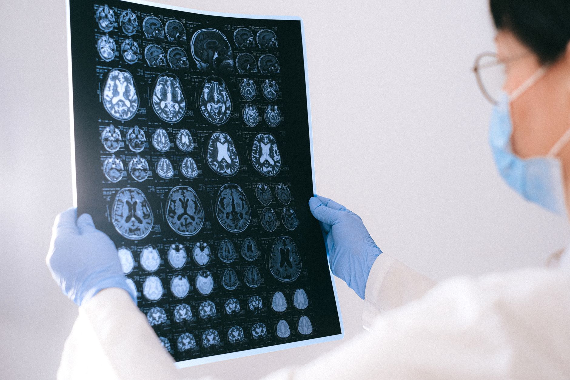 Research Shows that Neocortical Neuron Quantity is Not Linked to IQ, Indicating that Brain Connectivity is Crucial for Intelligence