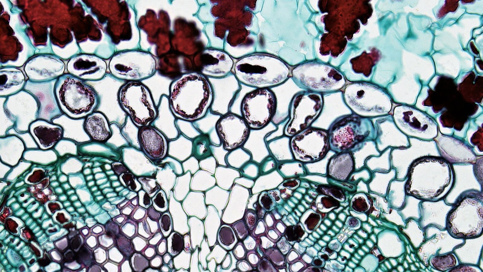 Swedish neuroscientist Peter Eriksson's 1998 breakthrough: Growth of neurons in the adult human brain is feasible, challenging long-standing beliefs.