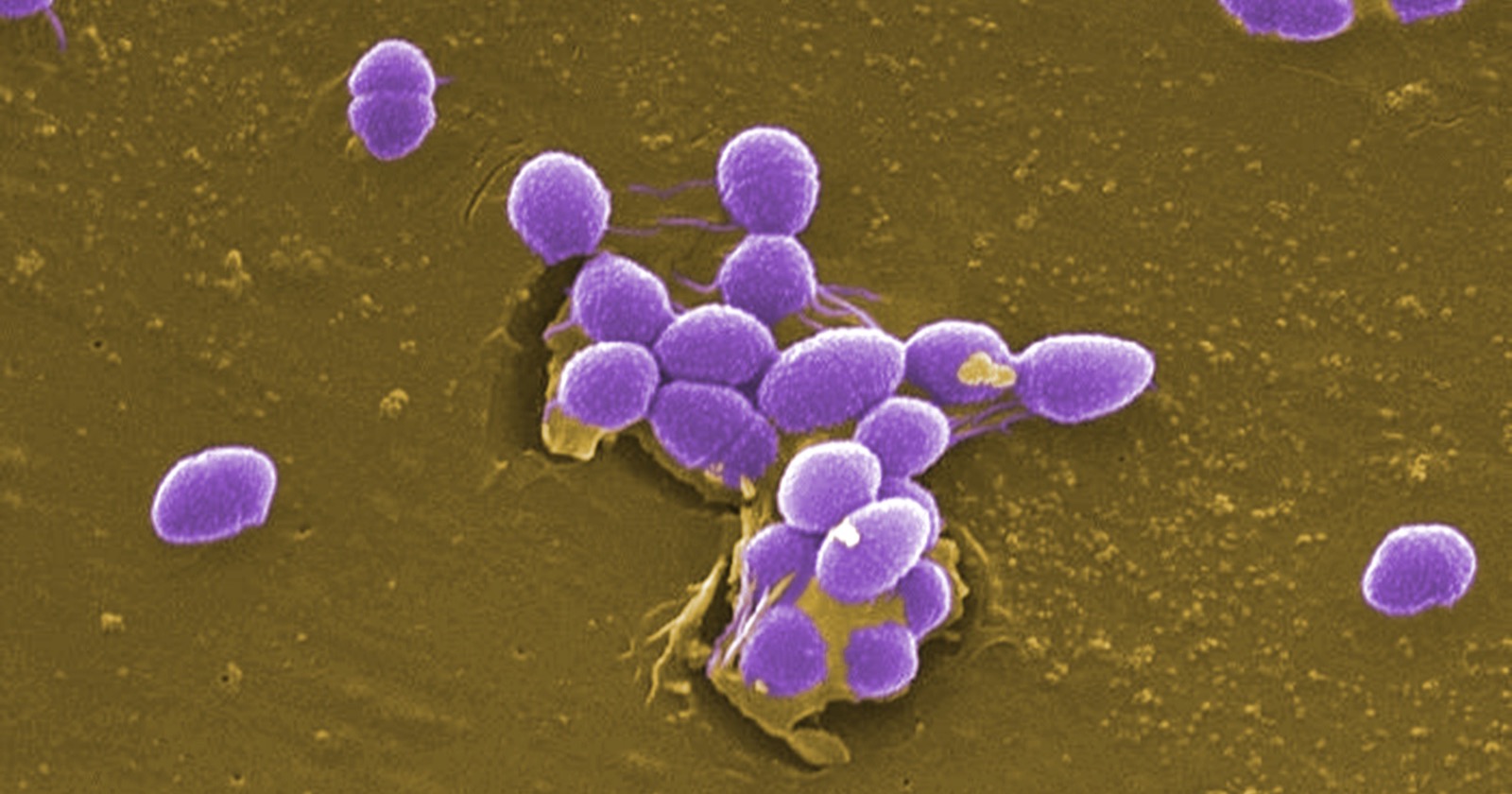 Research Reveals Extra 100 Grams of Sugar-Laden Foods Each Day Results in 24% Increased Loss of Gut Bacterial Diversity in Memorial Sloan Kettering Transplant Recipients on Broad-Spectrum Antibiotics